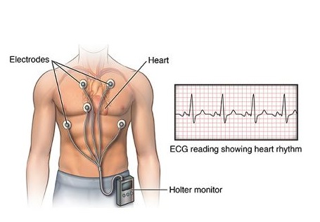 heart monitor