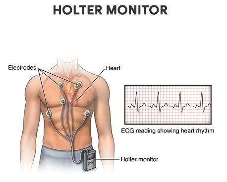 heart monitor