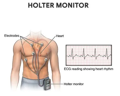heart monitor