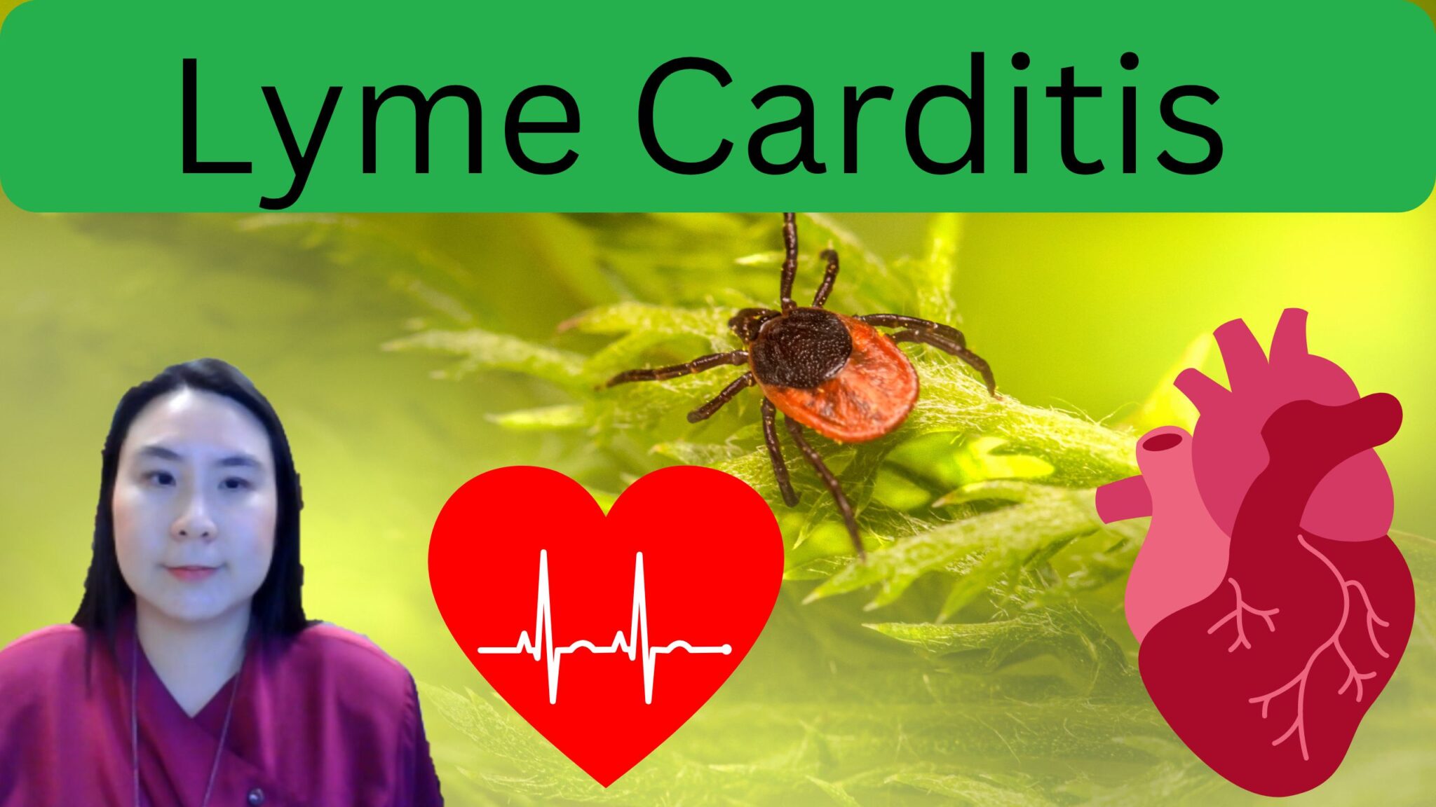 Lyme Carditis: Symptoms, Diagnosis, Treatment - Heart Care for Adults ...