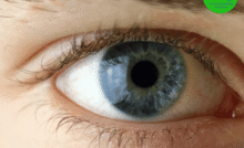 vision loss