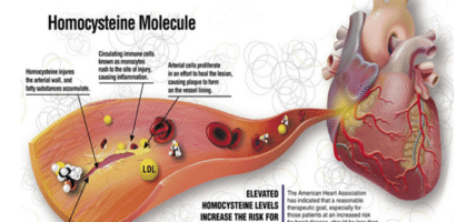 Homocysteine