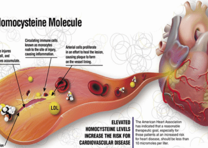 Homocysteine