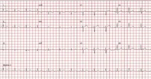 Electrocardiogram- concierge cardiology service