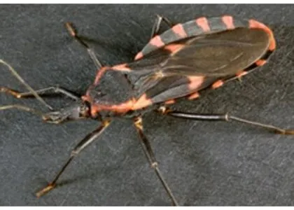 chagas disease